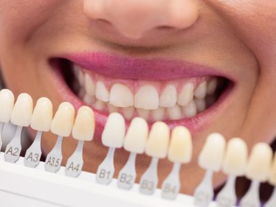 Dentist examining female patient with teeth shades at dental clinic Dentist examining female patient with teeth shades at dental clinic